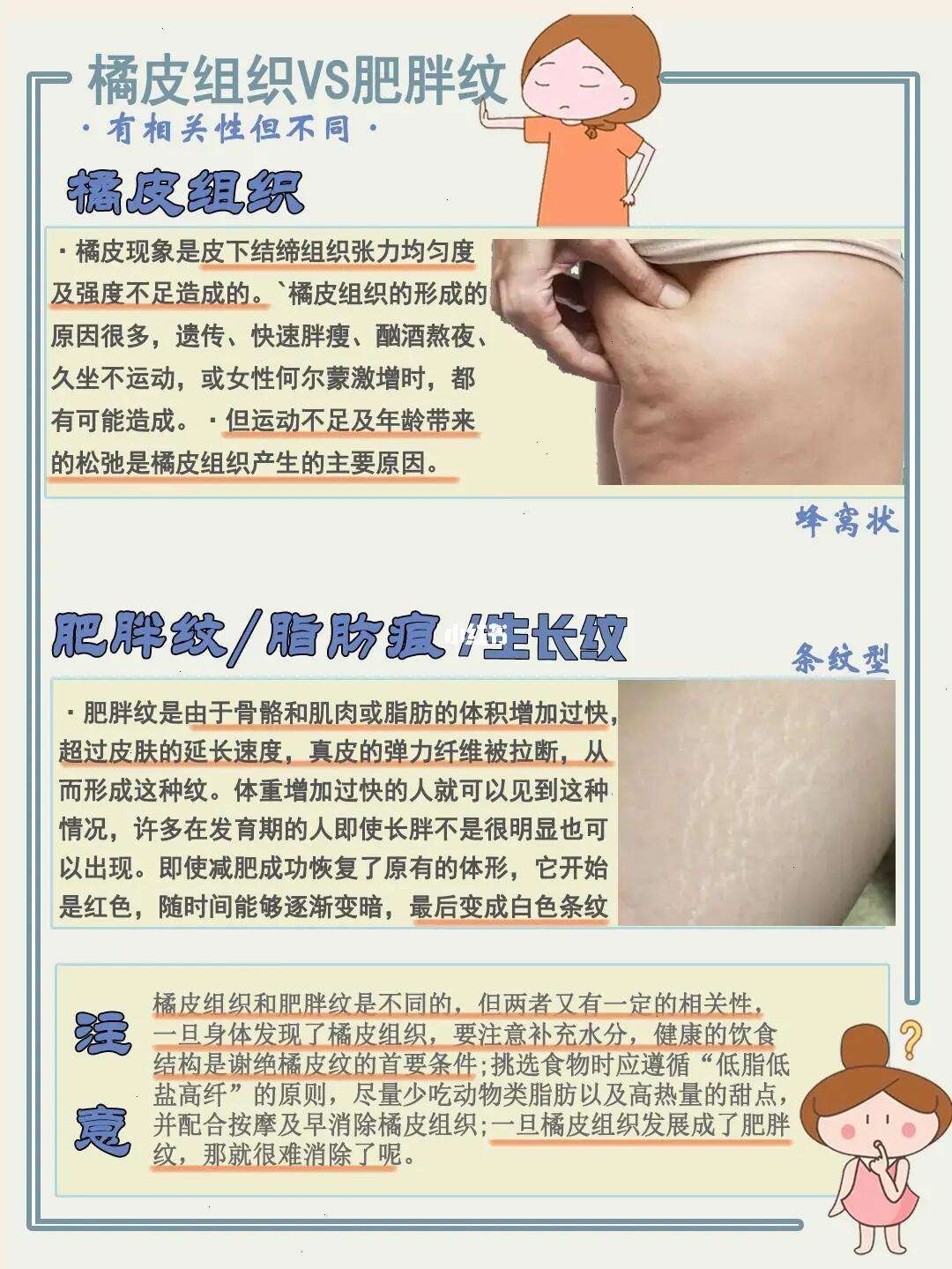 橘皮纹皮肤