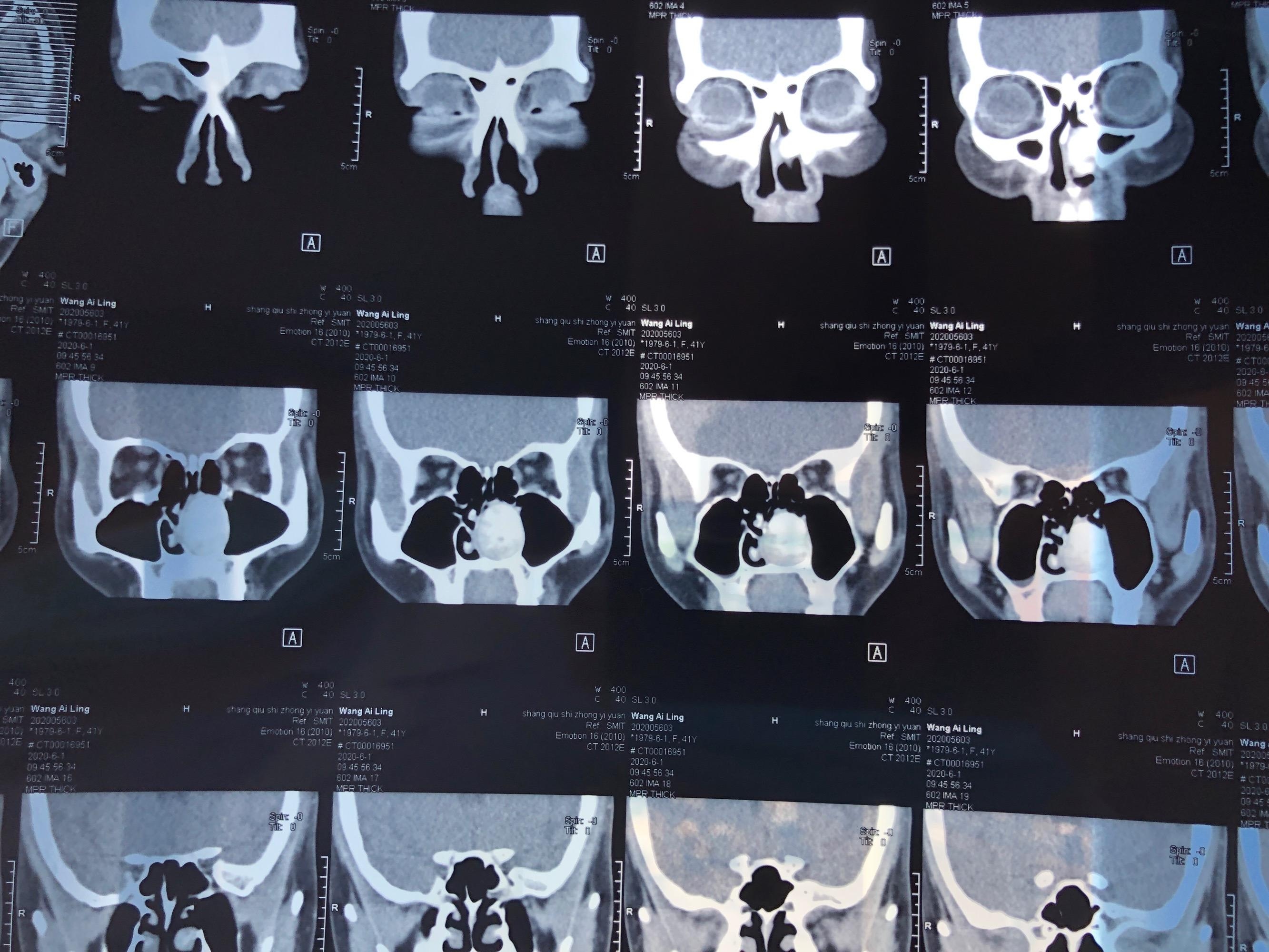Fig.FV 4-6-CT与MRI影像解剖学-医学