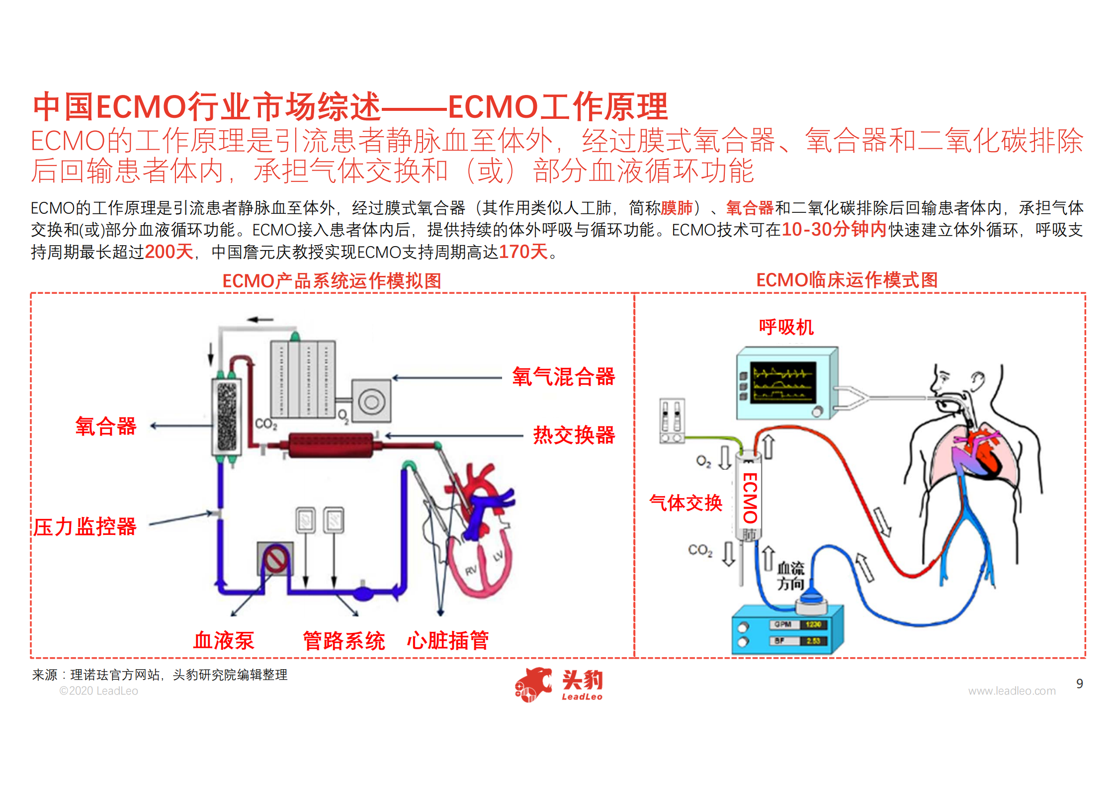 ecmo管路示意图