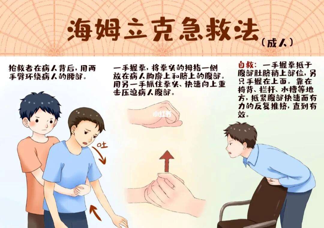 哈姆立克急救法