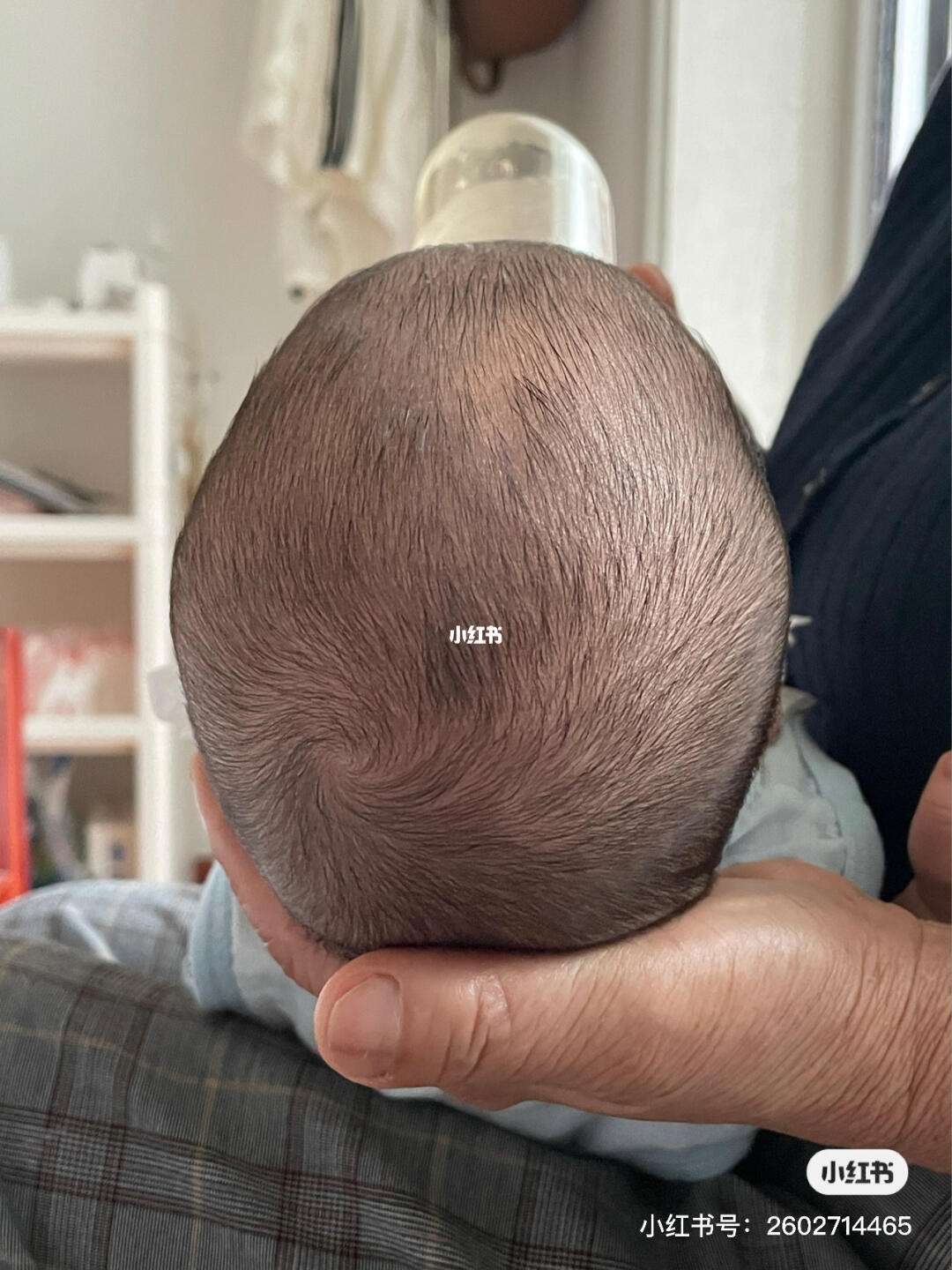 我儿子两周了最近发现他的两只耳朵上方和后脑勺出现头发稀少头皮有点发红这是怎么回事？_百度知道