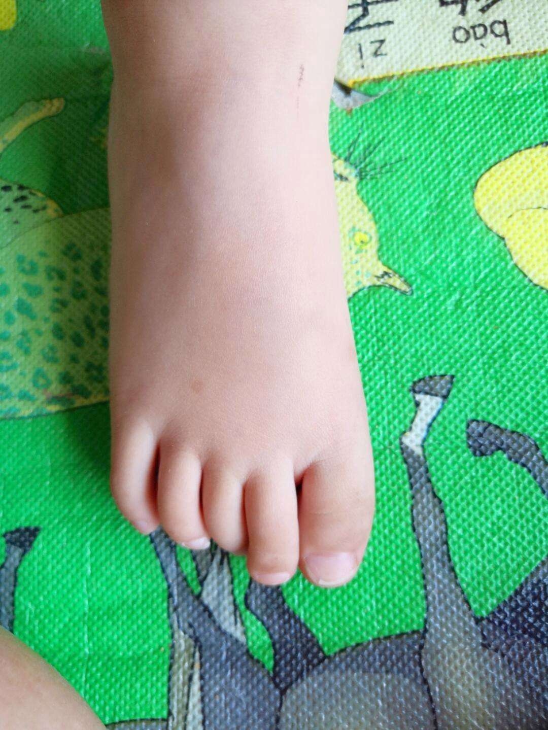 孩子从脚跟滚到脚趾。预防儿童扁平足。腿部运动。扁平足理疗。近距离照片摄影图片_ID:416507712-Veer图库