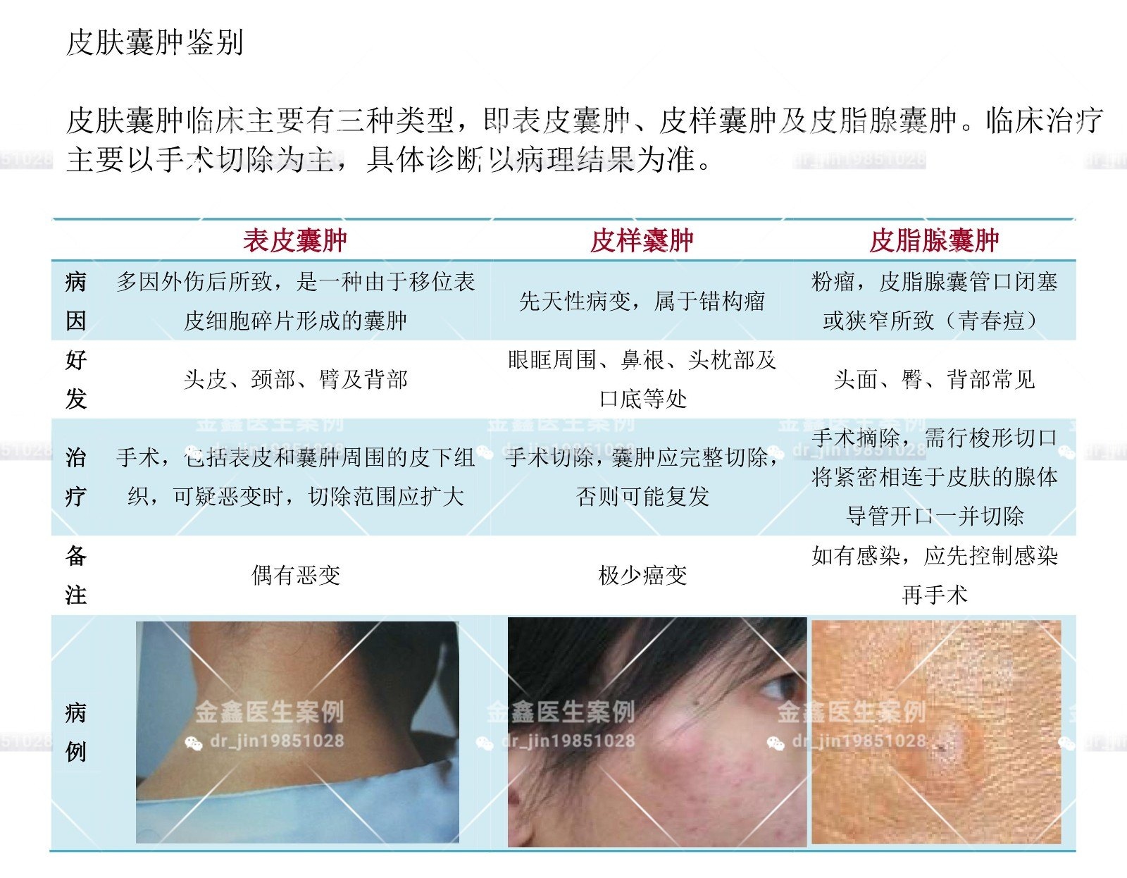 皮囊肿的症状和图片