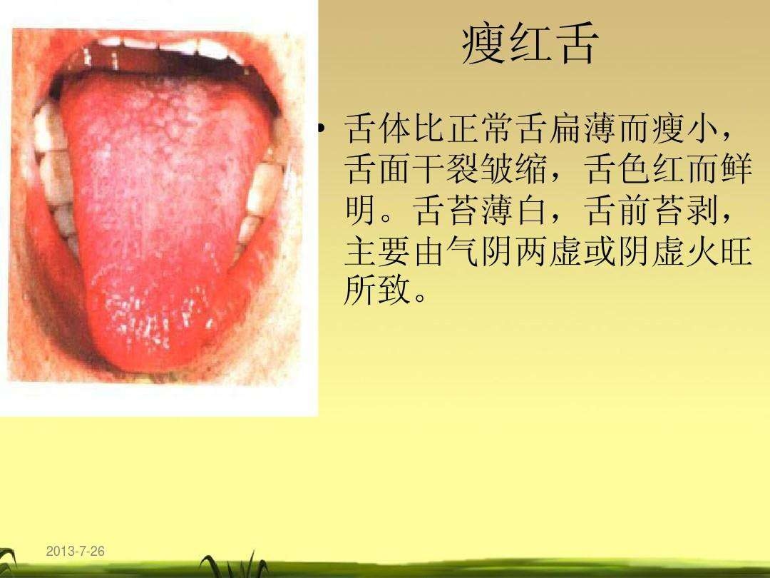 舌头的前世今生——望舌质——望舌形（瘦薄舌） - 知乎