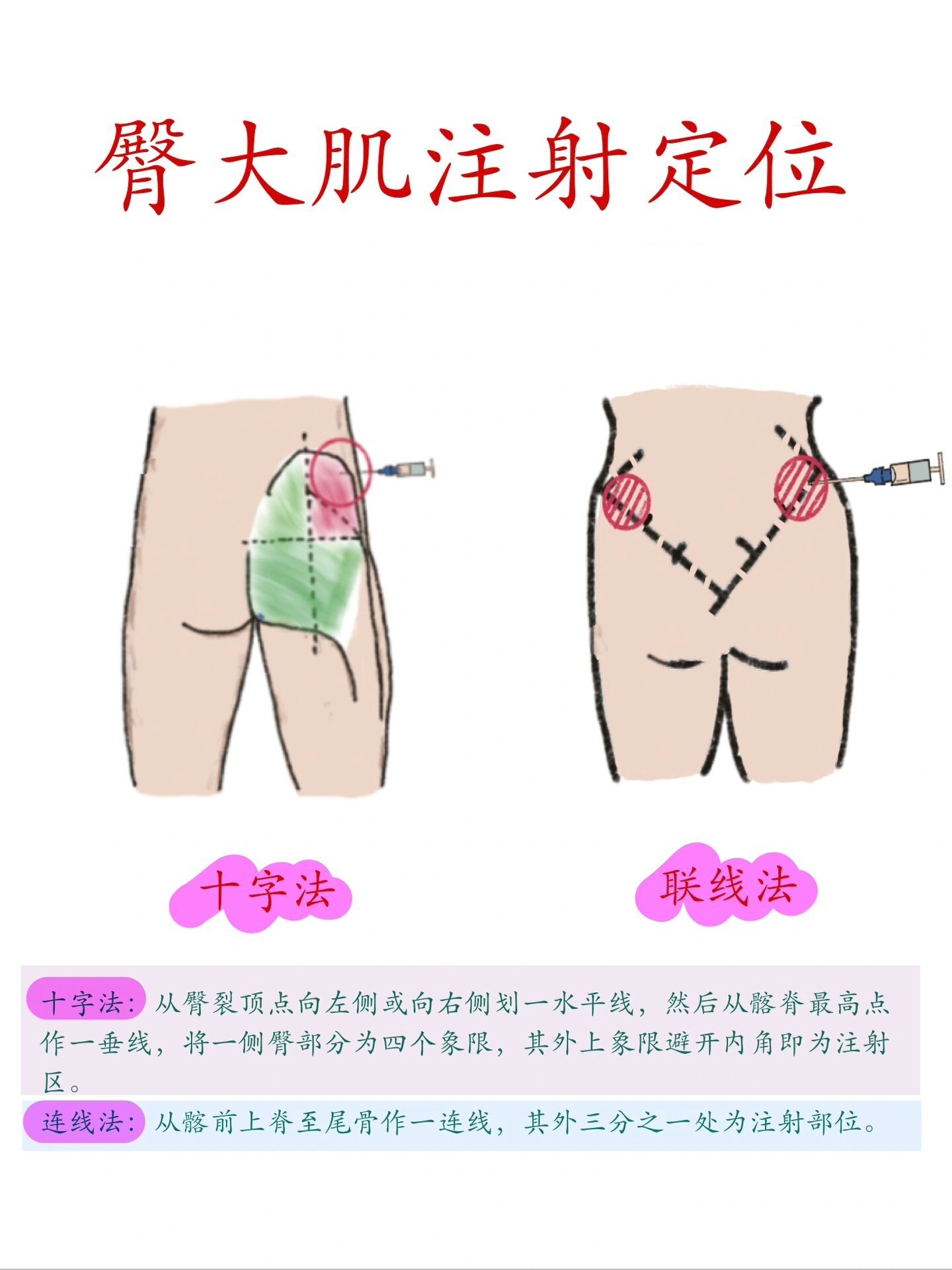 猪臀部注射部位在哪里