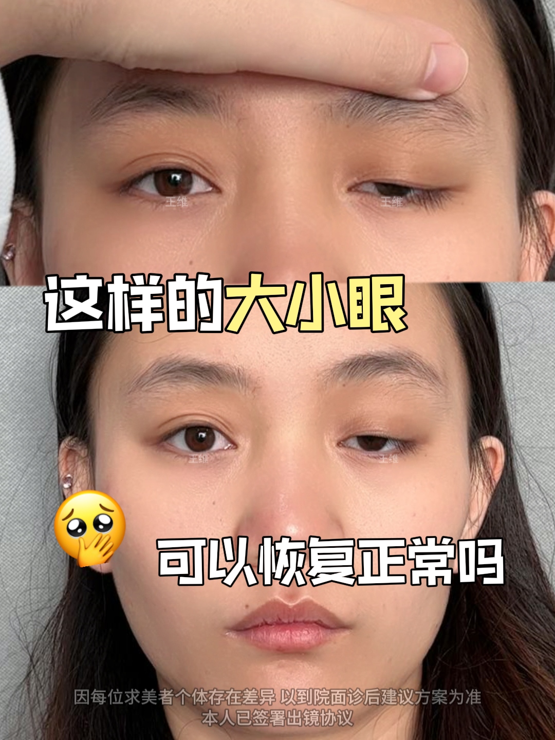 大小眼