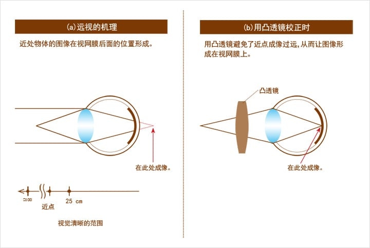 透镜篇 近视眼镜凹透镜原理图