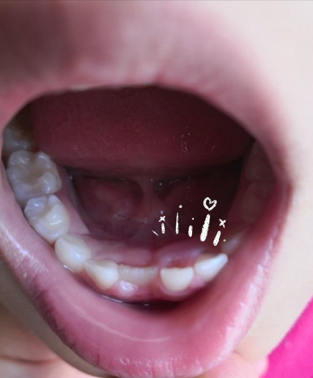 小孩要换多少颗牙齿图解换牙顺序（@宝爸宝妈们，儿童换牙期健康手册） | 说明书网
