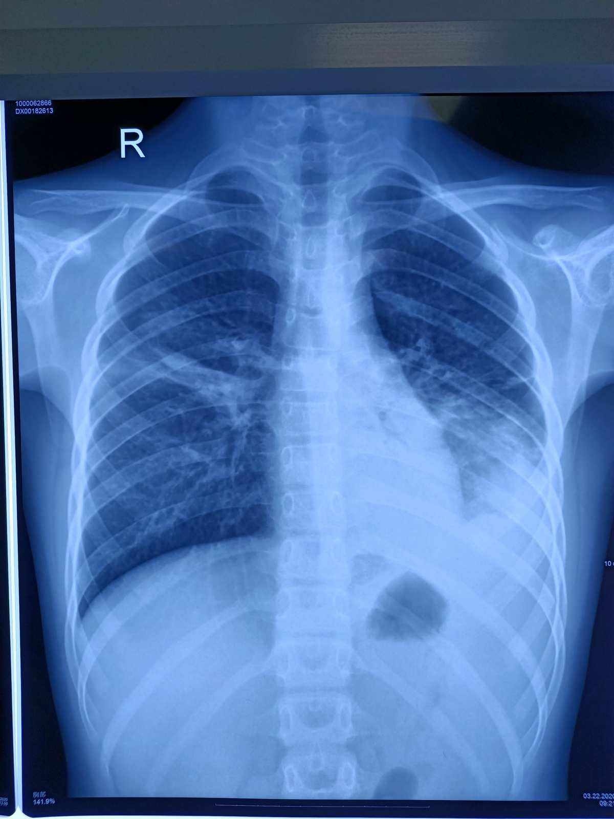 胸部CT道場: やさしイイ呼吸器教室