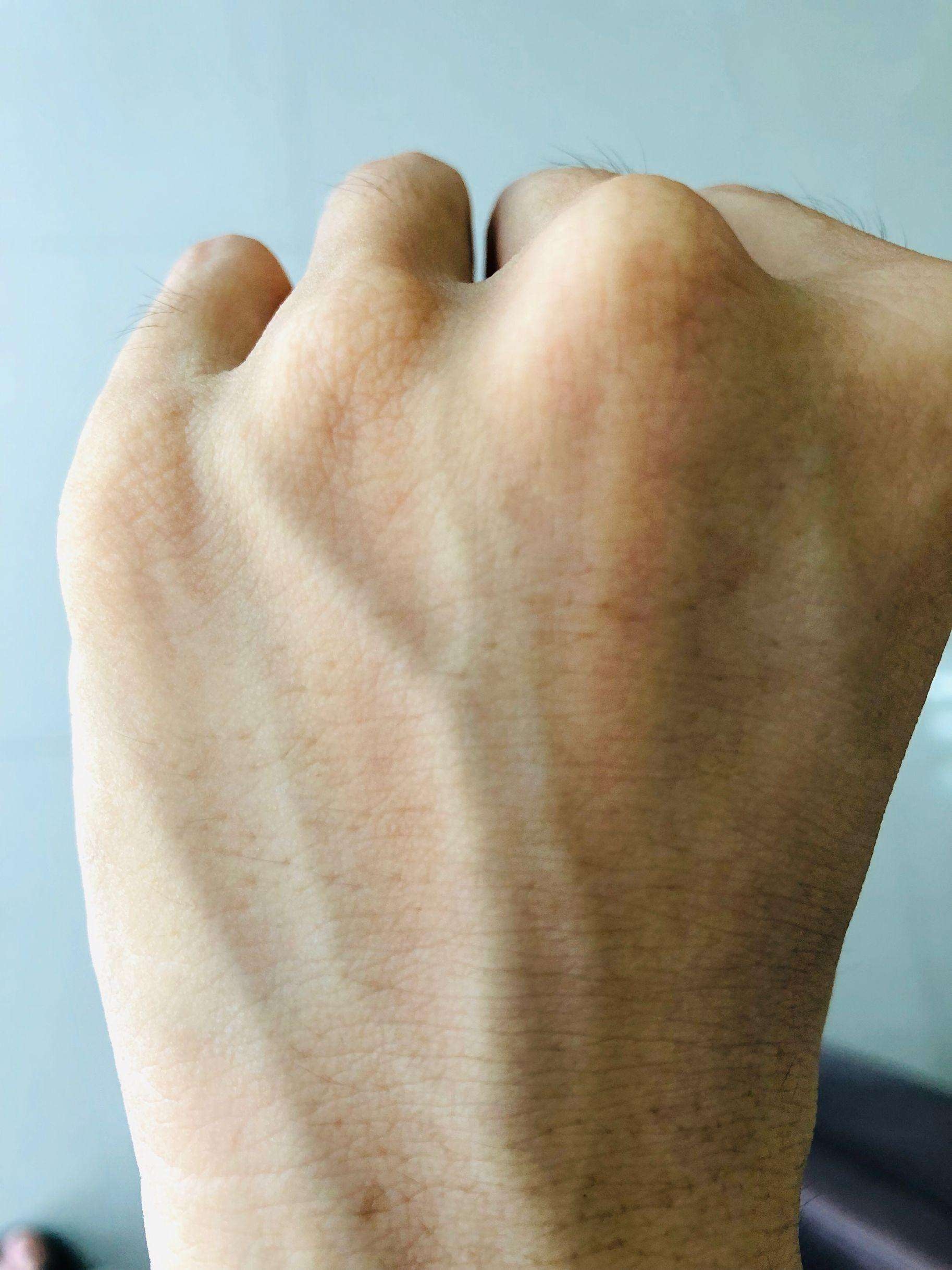 手上青筋凸起是一种病，说明身体差？它到底意味着什么-京东健康